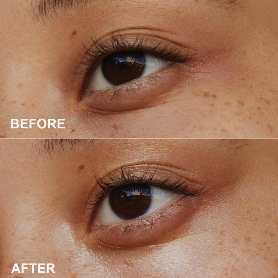 Anti-Wrinkle Eye Cream - ShreeBliss