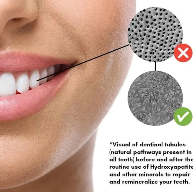 Remineralizing Gum - ShreeBliss