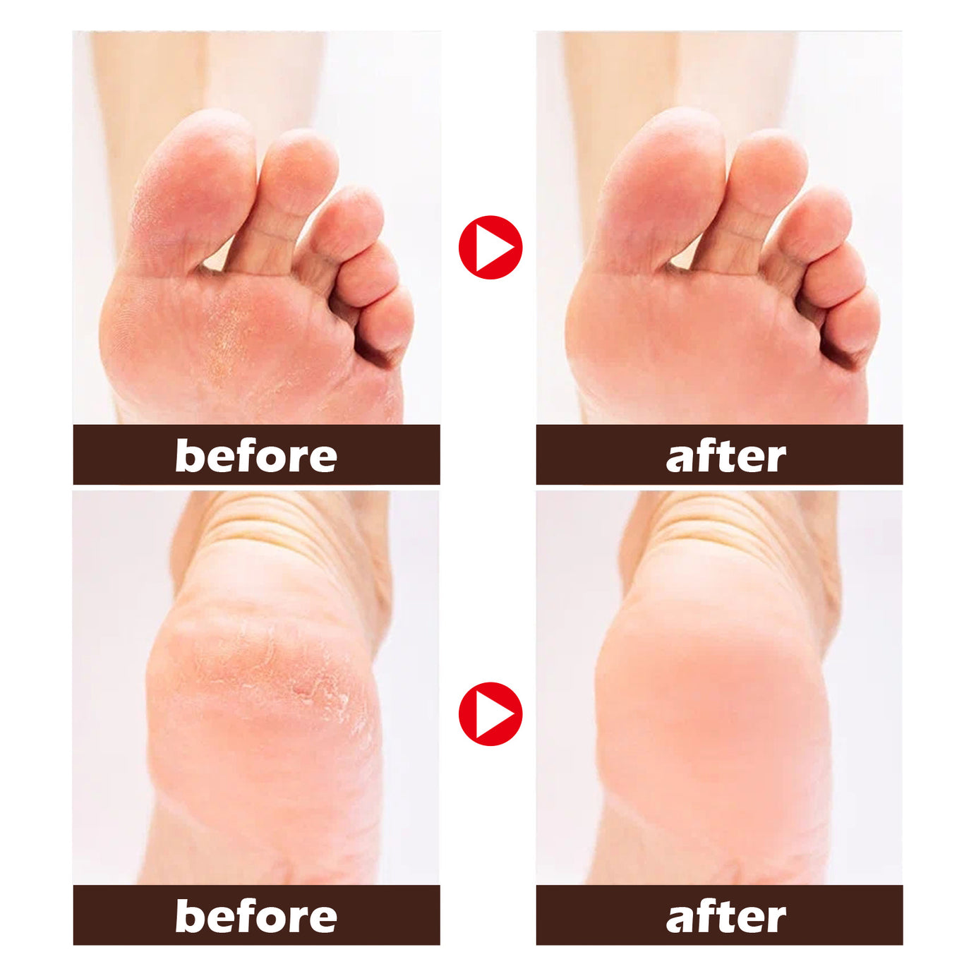 Horse Oil Foot Cream - ShreeBliss