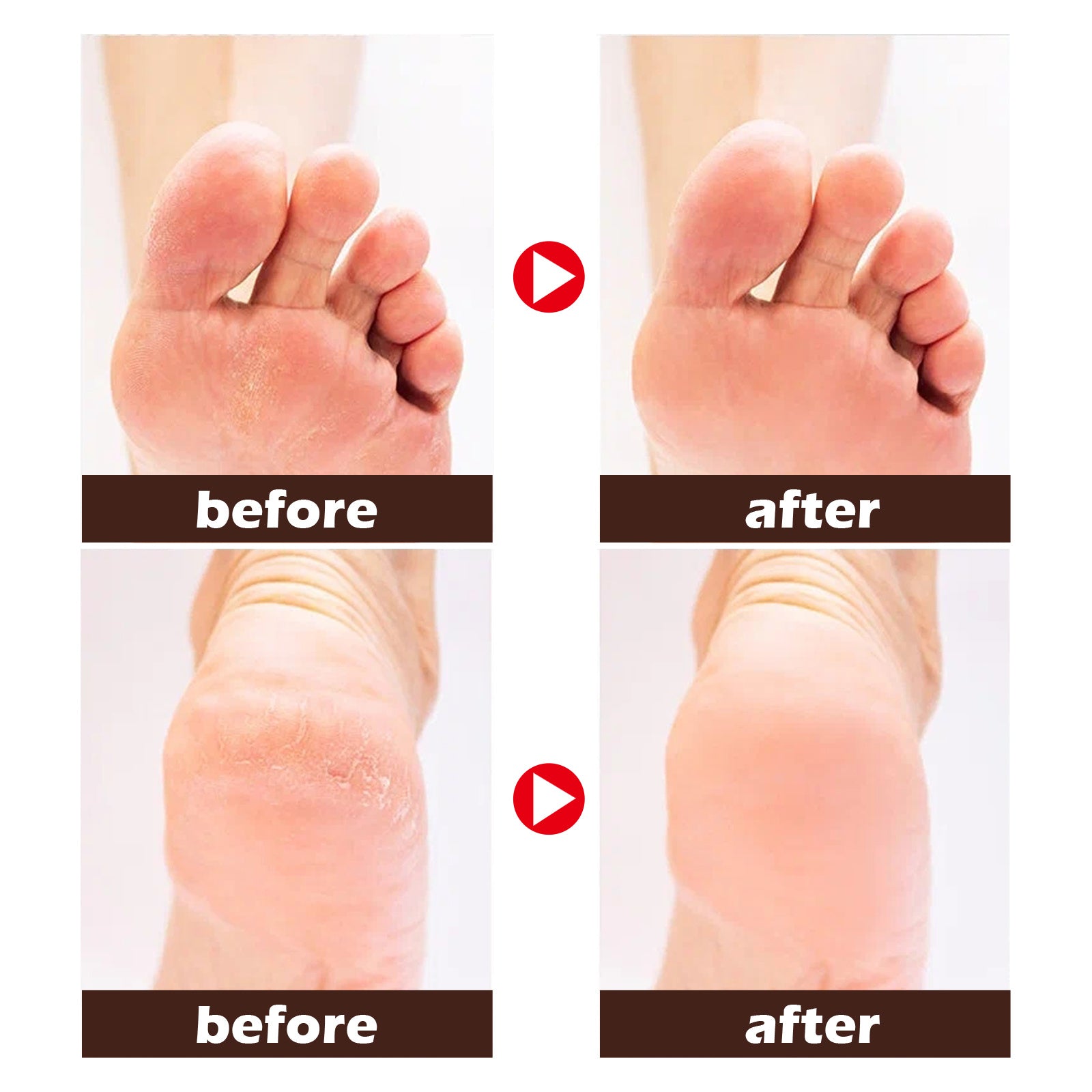 Horse Oil Foot Cream - ShreeBliss
