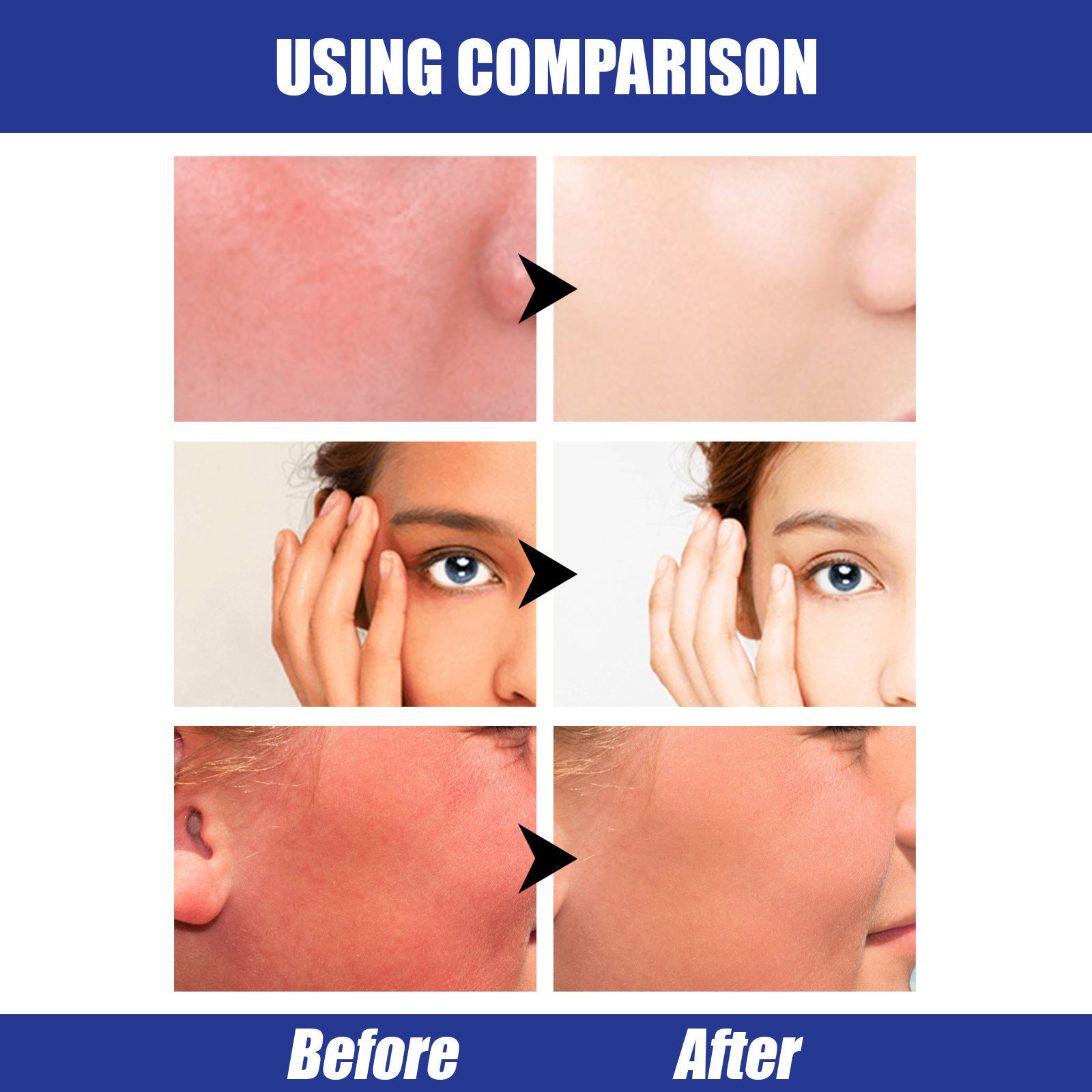 SPF50 Sun Block Stick - ShreeBliss